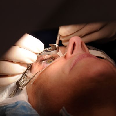 Bild zu Mit Risiko: Augenoperationen wie eine Lasik-OP