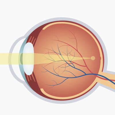 Bild zu Myopie-Management: Risikofaktoren frühzeitig erkennen