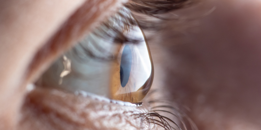 Infos & Tipps für Keratokonus